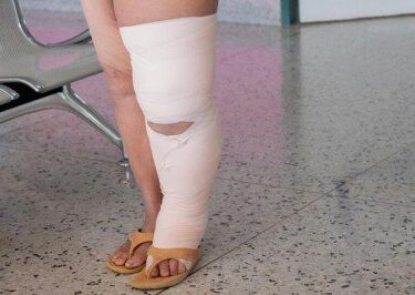 Lenfödem ve lipödem hakkında merak edilenler