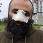 İş insanı dehşeti yaşadı! ‘Kendime aynada bakamıyorum’