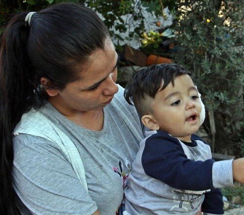 Pitbull saldırdı, baba ve 11 aylık oğlu hastanelik oldu