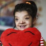Minik Ayşenur’un normalden daha ayrık olan gözleri ameliyatla yaklaştırıldı