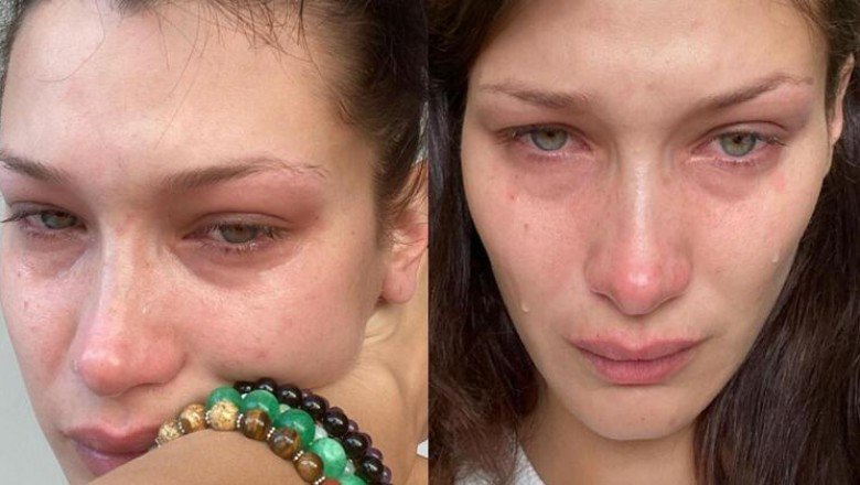 Bella Hadid’in iki gözü iki çeşme: Her gün, her gece ağlıyorum – Hürriyet