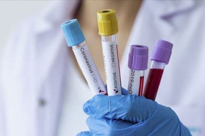 Prof. Dr. Tecer: Havada koronavirüsün RNA’sına rastladık