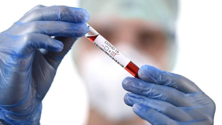 Bilim Kurulu üyesi Kara: Omicron’da klinik tablo ağır değil