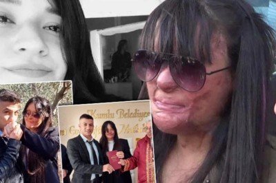 Türkiye günlerce Berfin Özek’i konuşmuştu! Yüzüne asit atan erkek arkadaşıyla evlendi