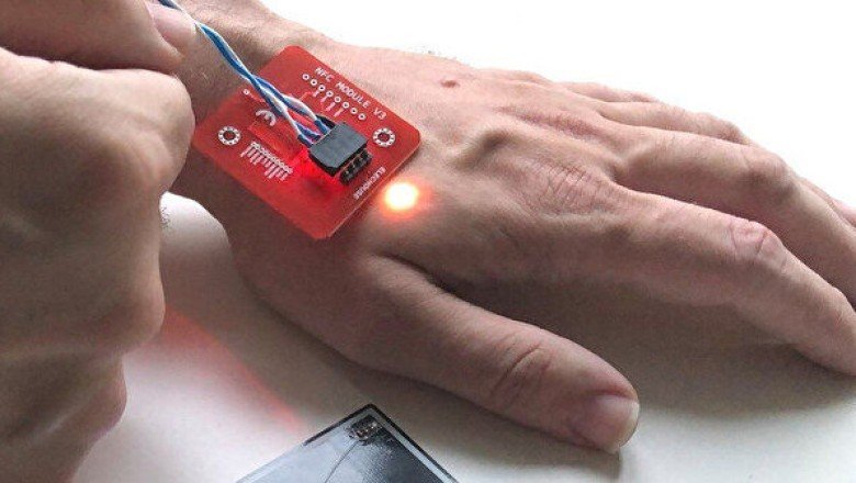 Elinizle ödeme yapmanızı sağlayan mikroçip implantları